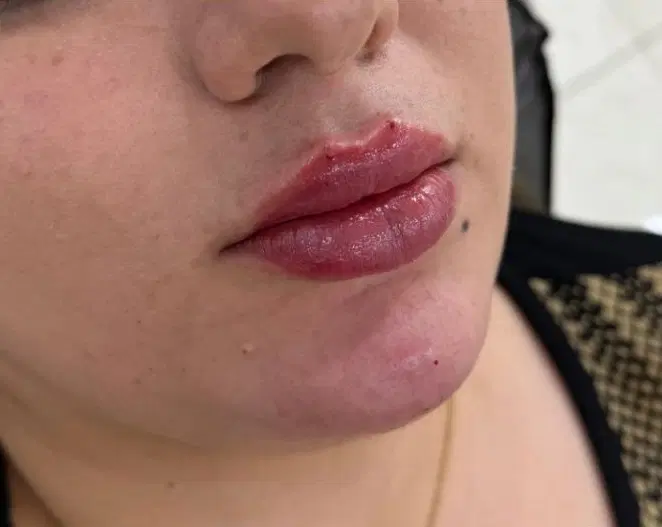 جشنواره ژل توسط پزشک برای شما عزیزان|خدمات زیبایی و سلامت|کرمانشاه, |دیوار