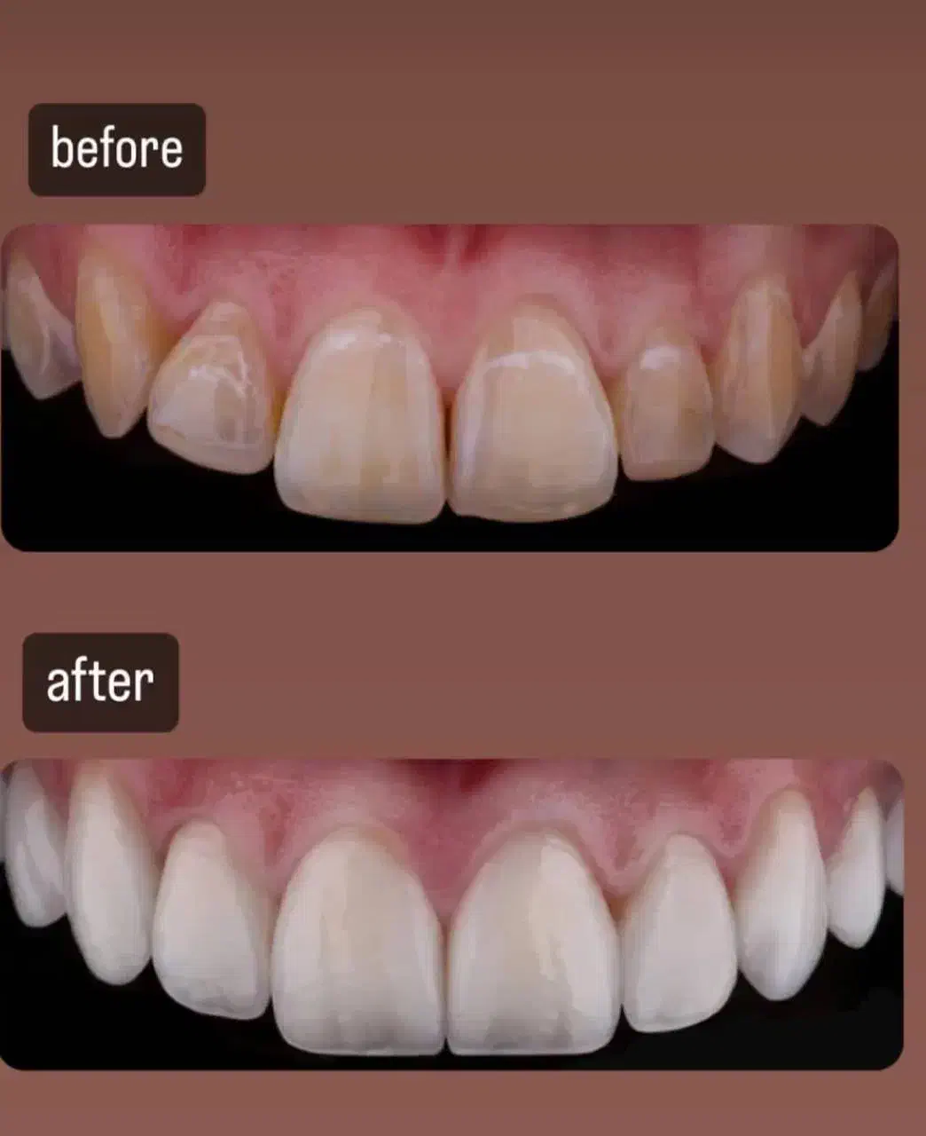 زیبایی|خدمات آرایشگری و زیبایی|تهران, جردن|دیوار