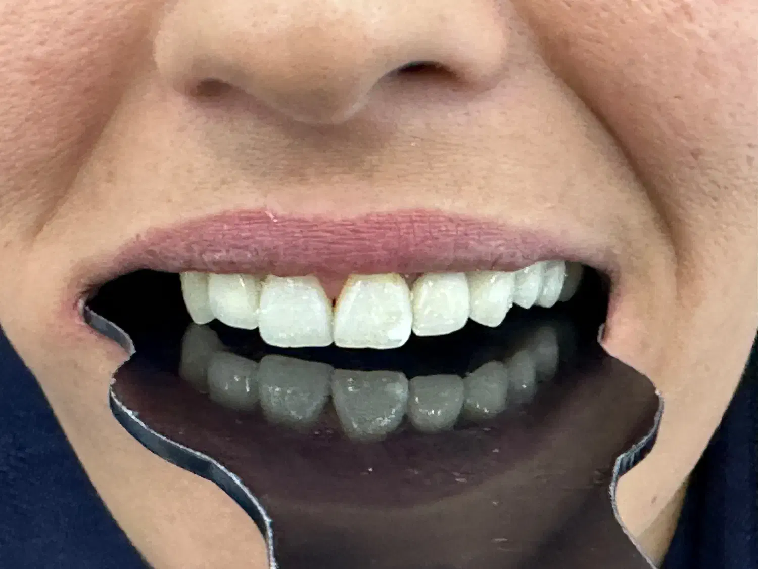 استخدام دستیار دندانپزشک|استخدام درمانی، زیبایی، بهداشتی|تهران, دکتر هوشیار|دیوار