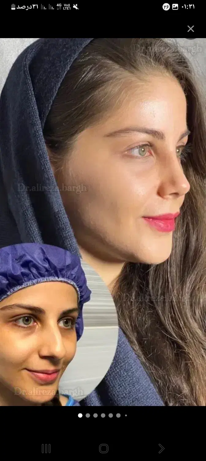 بمب تخفیف عمل بینی ۵۰درصد واقعی|خدمات زیبایی و سلامت|تهران, نظامی گنجوی (توانیر)|دیوار
