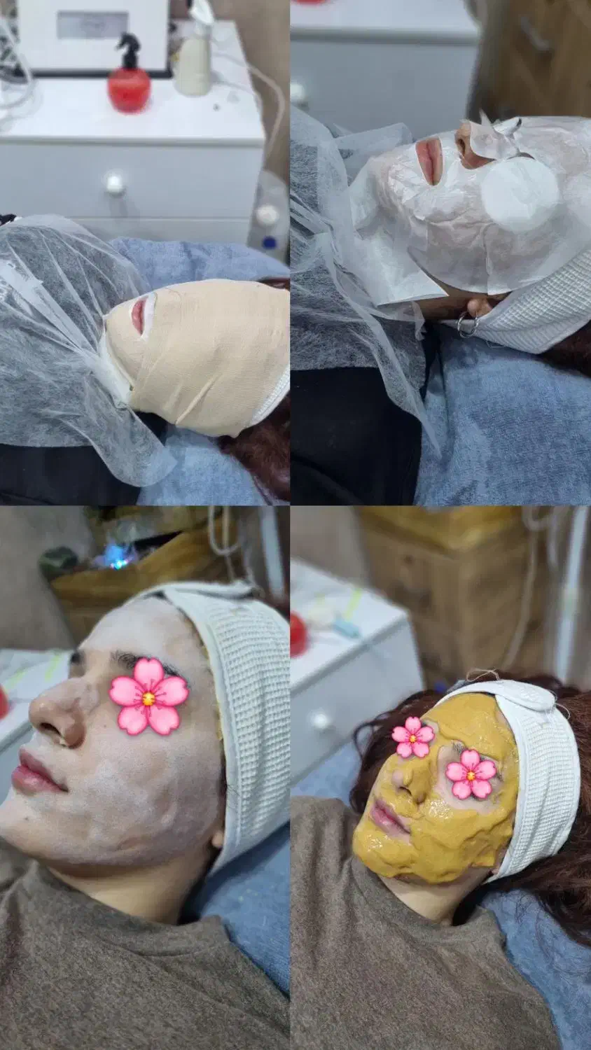 فیشیال تخصصی توسط پیراپزشک با۳۰٪تخفیف درکلینیک|خدمات آرایشگری و زیبایی|شیراز, خلدبرین|دیوار