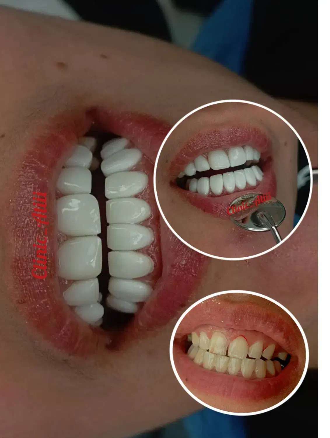 آموزش تخصصی کامپوزیت|خدمات آموزشی|اهواز, نادری|دیوار