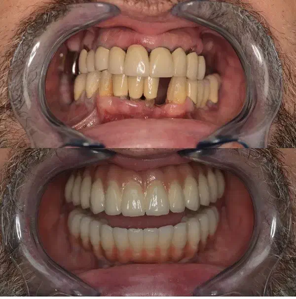 اقساط دندانپزشکی بدون پرداخت پول کلیه خدمات|خدمات آرایشگری و زیبایی|اصفهان, دشتستان|دیوار