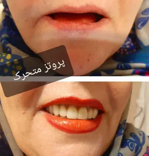 دندانسازی ناب نصف قیمت بازار|پزشکی|شیراز, حجت آباد|دیوار