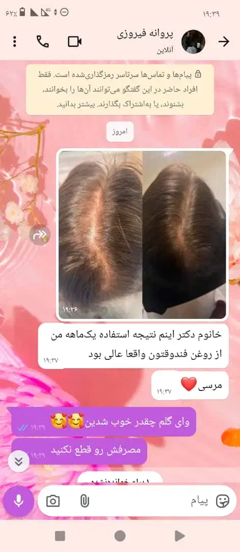 روغن تراپی|آرایشی، بهداشتی، درمانی|اهواز, عامری|دیوار