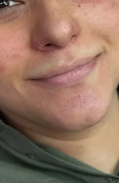 ریموو تخصصی شیدینگ لب بنمژه میکرو فیبروز تتوتضمینی|خدمات آرایشگری و زیبایی|قم, آزادگان|دیوار