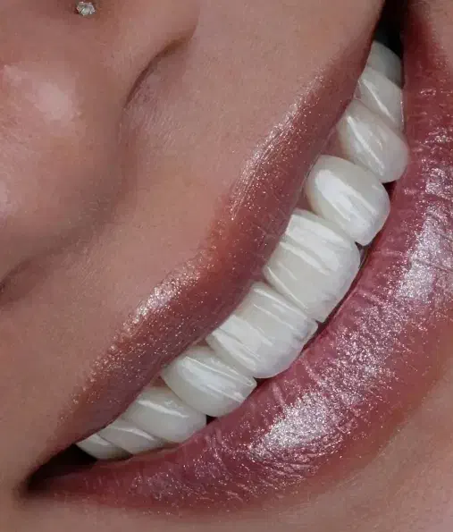 دندانپزشکی،ایمپلنت، اوردنچر|خدمات آرایشگری و زیبایی|مرند, |دیوار