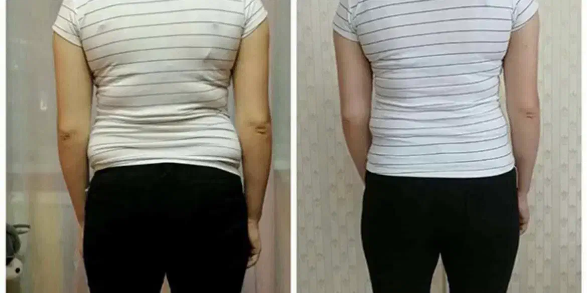 لاغری موضعی بادستگاه،مزوتراپی چربی سوز،رژیم درمانی|خدمات آرایشگری و زیبایی|زنجان, |دیوار