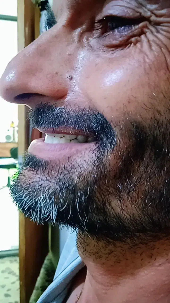 لابراتوار دندانسازی های دنت|پزشکی|بجنورد, |دیوار