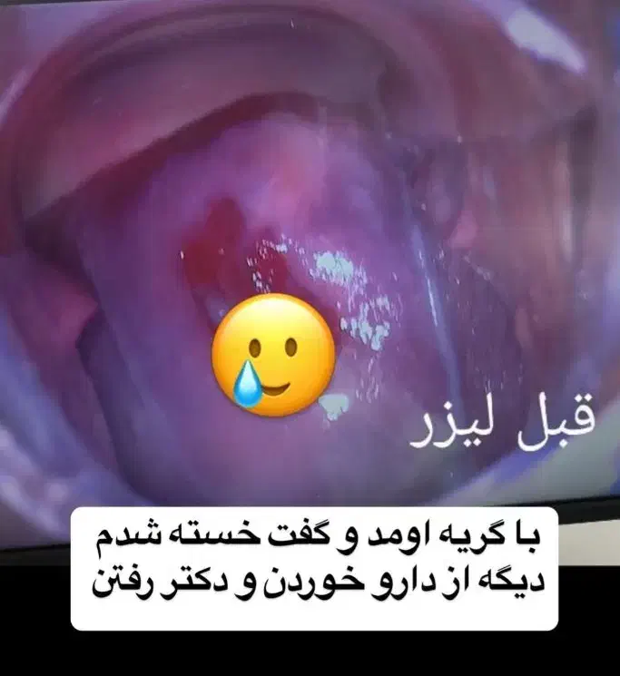 مطب زنان و بیماری‌های زنان وعفونت|خدمات آرایشگری و زیبایی|اهواز, نادری|دیوار