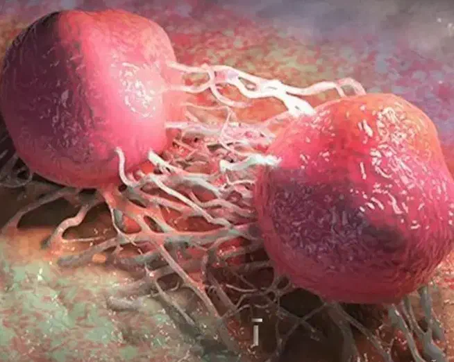 بهبود پروستات مجاری ادراری با نتیجه قطعی و تضمینی|خدمات آرایشگری و زیبایی|سنندج, |دیوار