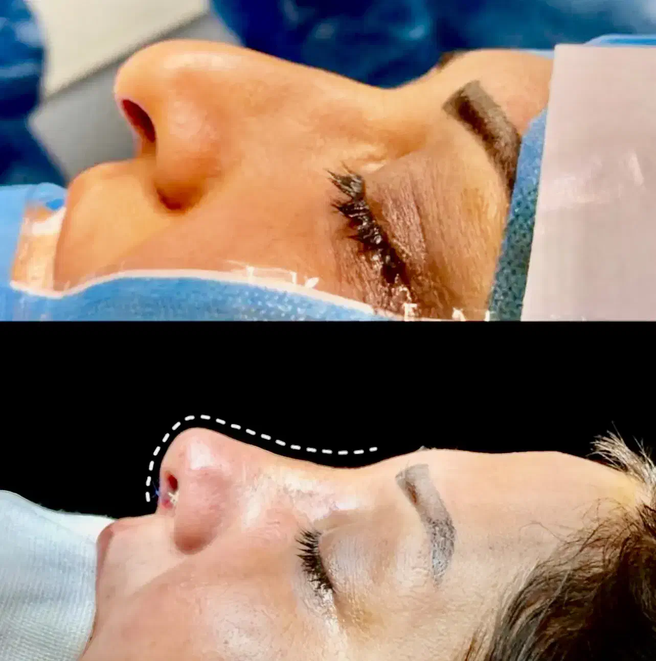 عمل بینی با شرایط ویژه(ماهانه ۱۰تومن)|خدمات آرایشگری و زیبایی|مهاباد (آذربایجان غربی), |دیوار