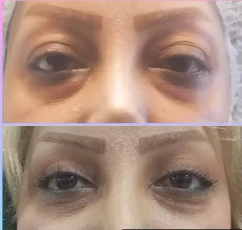 پزشک مسلط به جراحی بلفاروپلاستی|خدمات آرایشگری و زیبایی|تهران, سلسبیل شمالی|دیوار