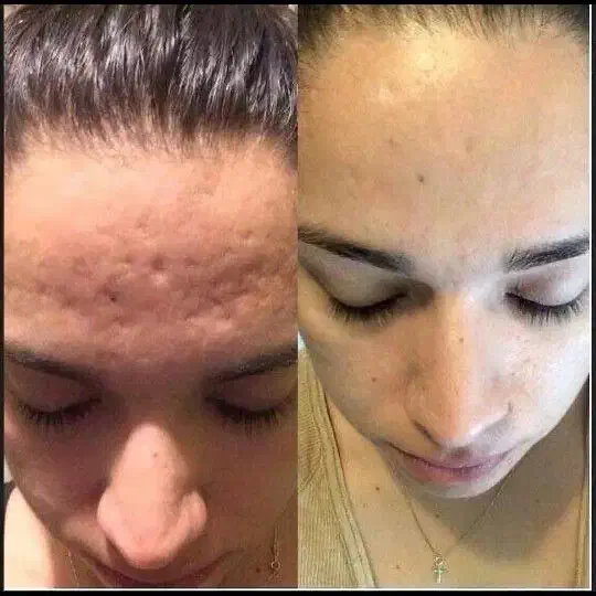 آموزش تکنیک فلت|خدمات آموزشی|شیراز, تاچارا|دیوار