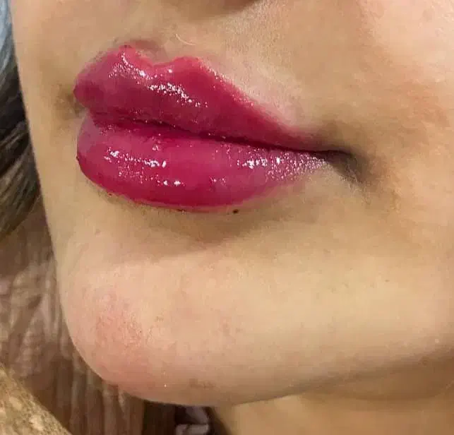 فروش و مدل ژل و بوتاکس|خدمات آرایشگری و زیبایی|اندیکا, |دیوار