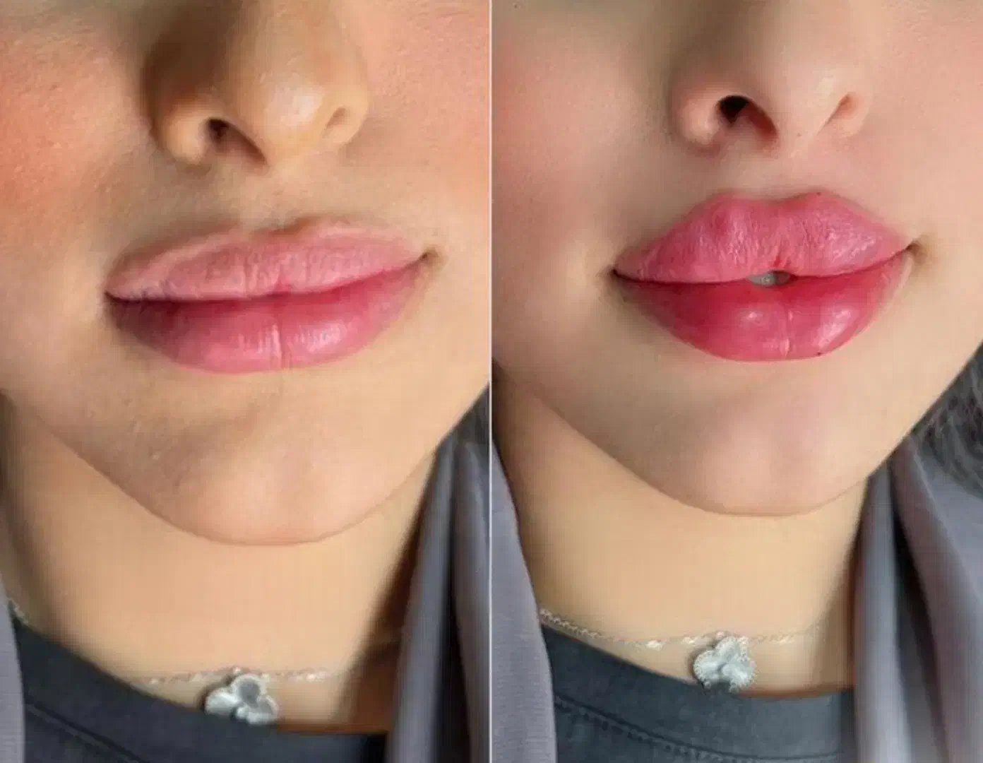 پزشک متخصص ژل و بوتاکس لیفت بانخ افزایش سایزآلت|خدمات آرایشگری و زیبایی|قم, صفائیه|دیوار