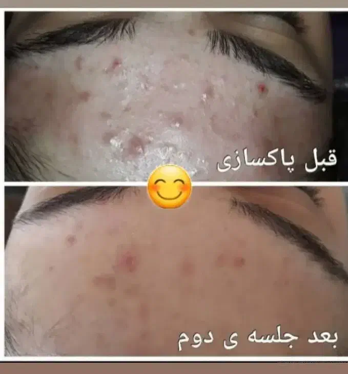 فشیال وپاکسازی تخصصی|خدمات آرایشگری و زیبایی|نورآباد ممسنی, |دیوار