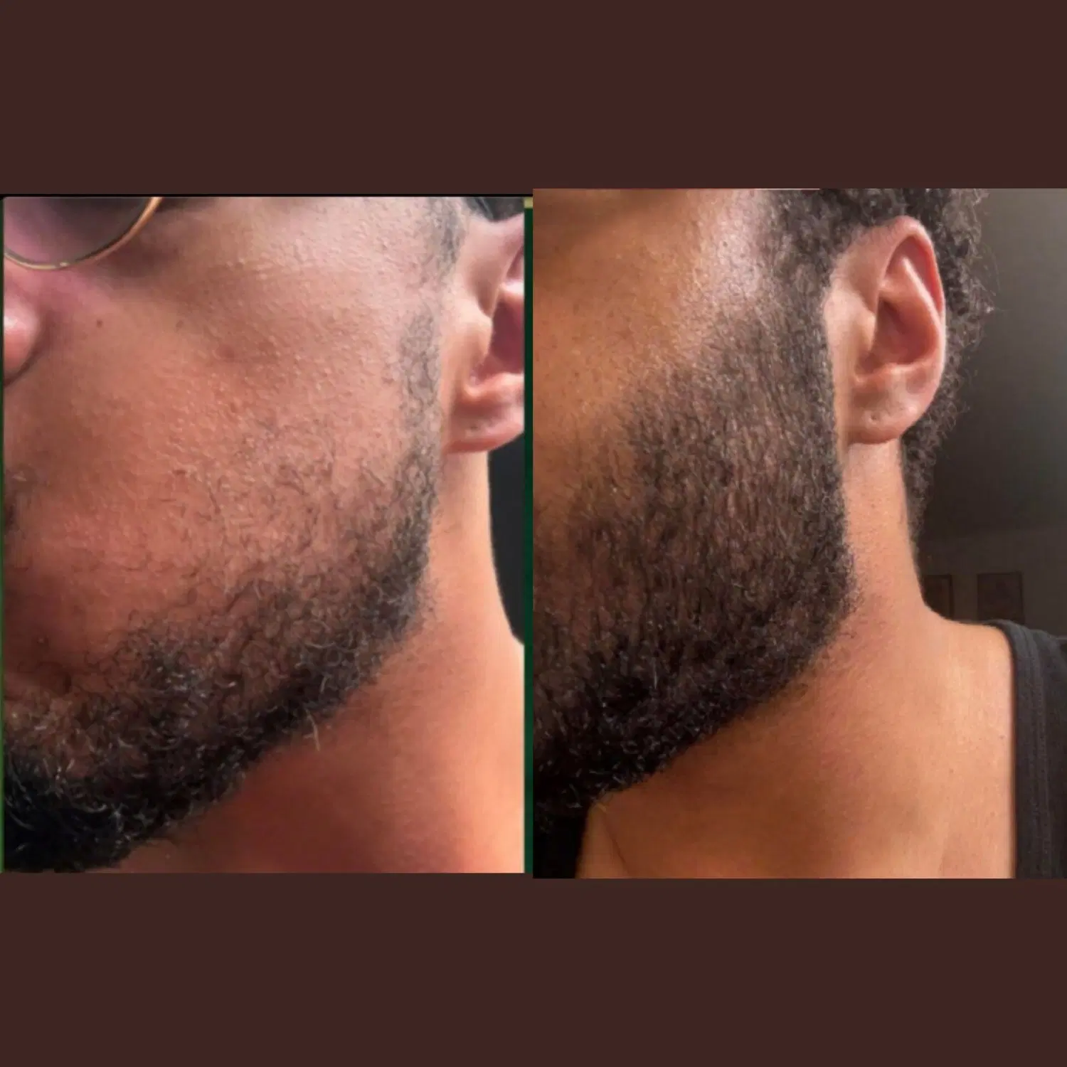 (قطع ریزش مو فقط در یک جلسه) تضمینی|خدمات آرایشگری و زیبایی|مشهد, شریف|دیوار