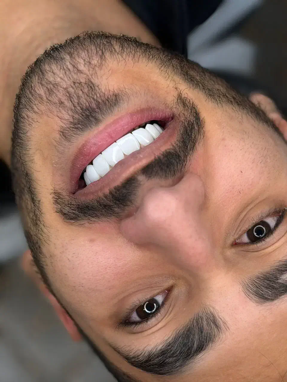 دنداپزشکی کامپوزیت دندان|خدمات آرایشگری و زیبایی|پرند, فاز ۲|دیوار