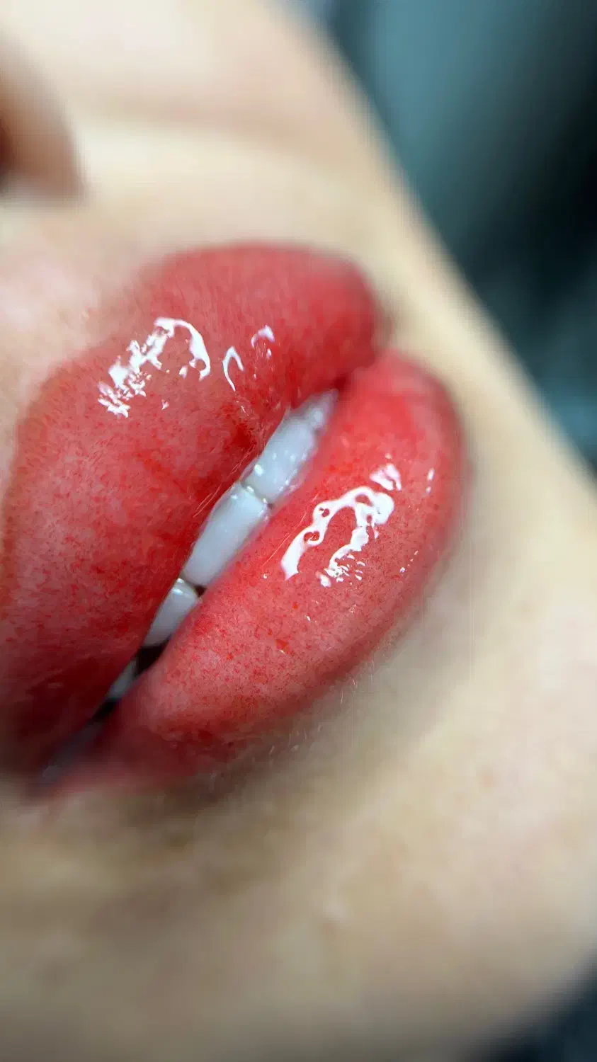 خدمات تخصصی ریمووتتوومیکروپیگمنتیشن ولیفت|خدمات آرایشگری و زیبایی|گنبد کاووس, |دیوار