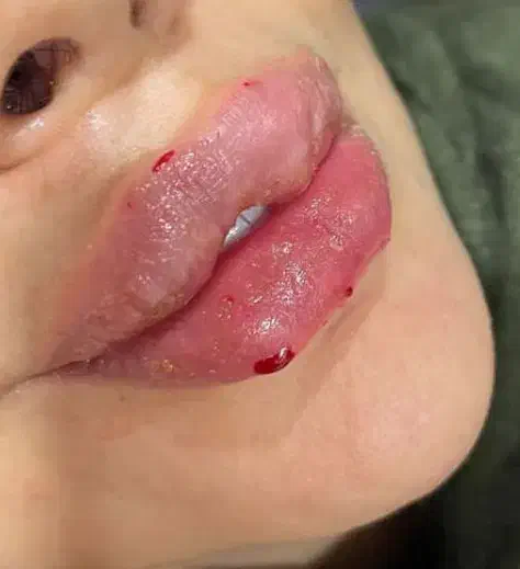 کیلینیک نیولایف لیزر بانوان ۳۰۰ آقایان ۶۰۰|خدمات آرایشگری و زیبایی|کرج, گوهردشت|دیوار