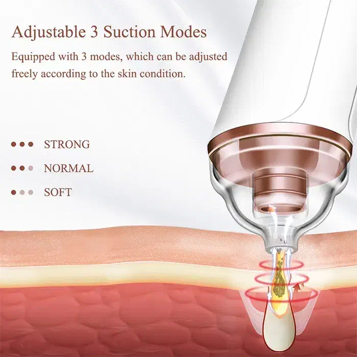 میکرودرم پوست لوویکا مدل X1003|آرایشگاه و سالن‌های زیبایی|تهران, علم و صنعت|دیوار