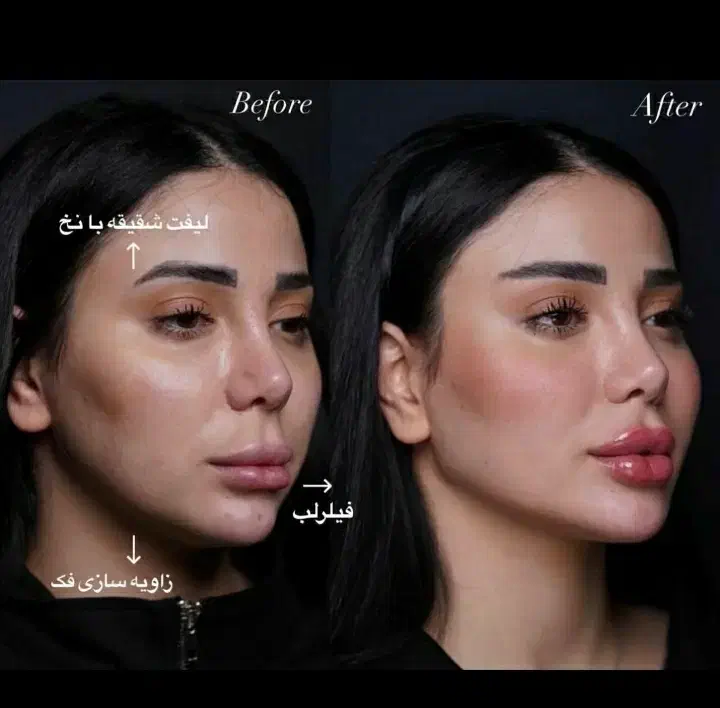 مطب زیبایی تپش .جشنواره تخفیف/لیزر/ژل بوتاکس|خدمات آرایشگری و زیبایی|گلبهار, شهر جدید گلبهار|دیوار