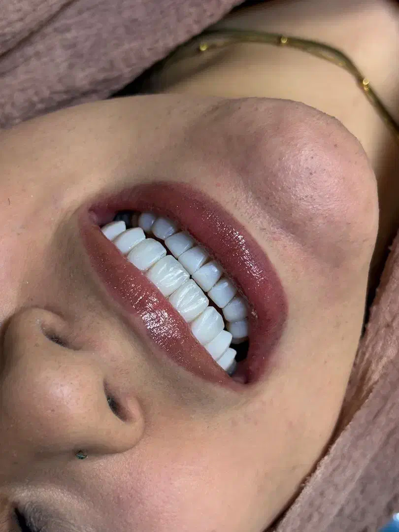 زیبایی دندان با قیمت مناسب و کیفیت بالا|خدمات آرایشگری و زیبایی|تهران, سازمان برنامه شمالی|دیوار