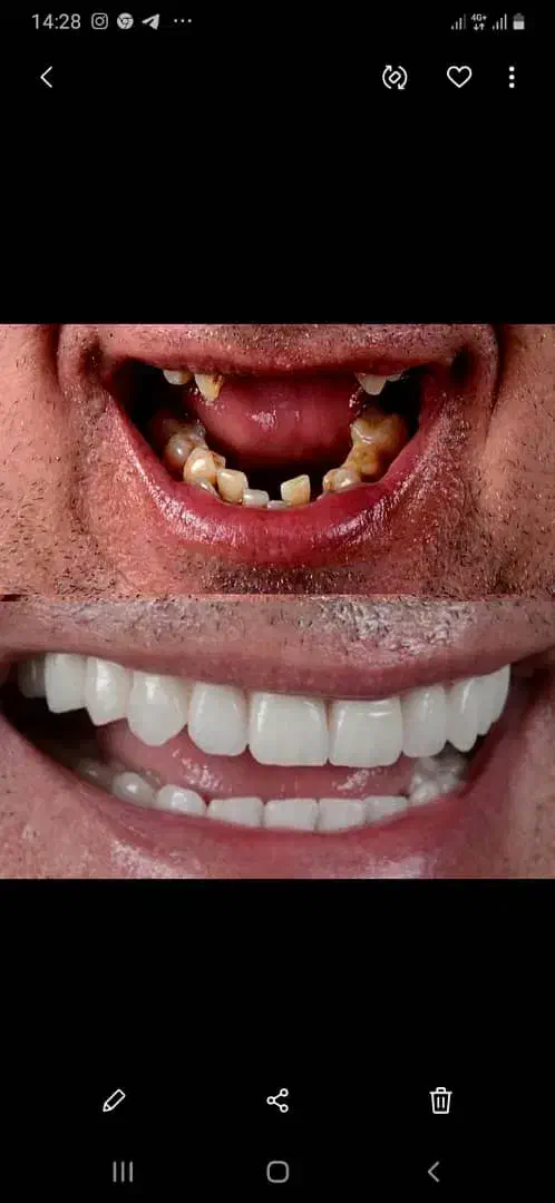 کلیه خدمات دندانپزشکی . زیبایی|خدمات آرایشگری و زیبایی|رشت, گلسار|دیوار