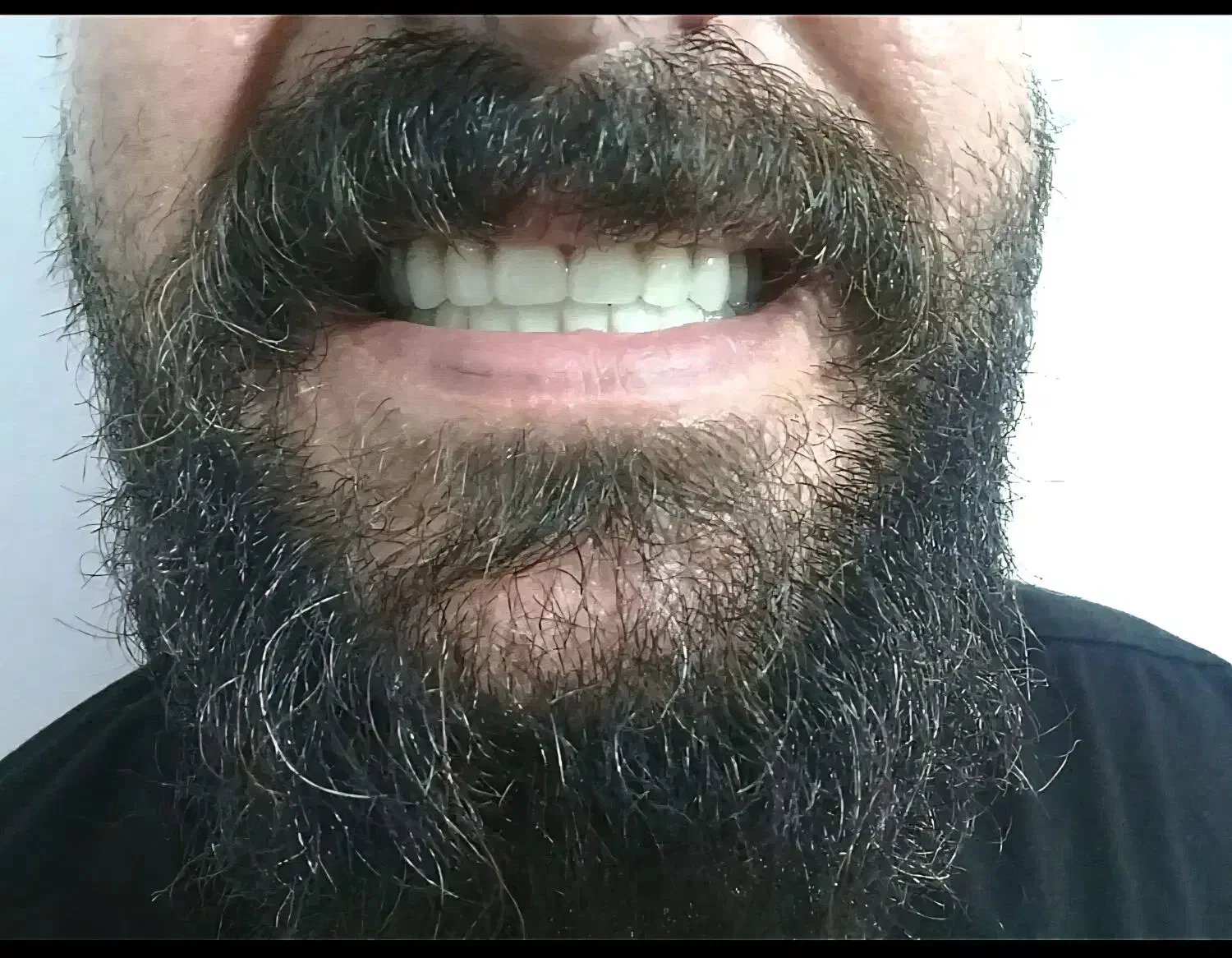 ساخت دندان مصنوعی(تحویل در ۳ جلسه)|خدمات آرایشگری و زیبایی|زنجان, |دیوار