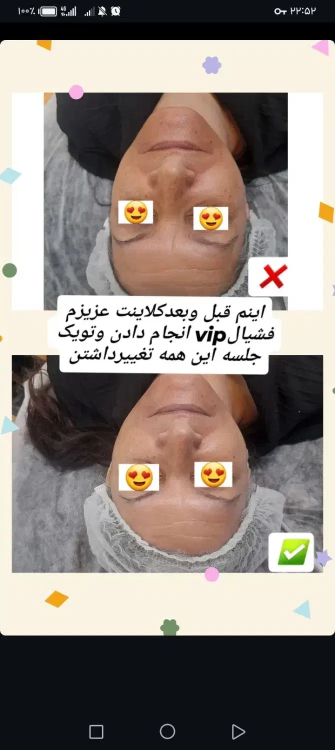 مدل فیشیال و پاکسازی|خدمات آرایشگری و زیبایی|تربتحیدریه, کاشانی|دیوار