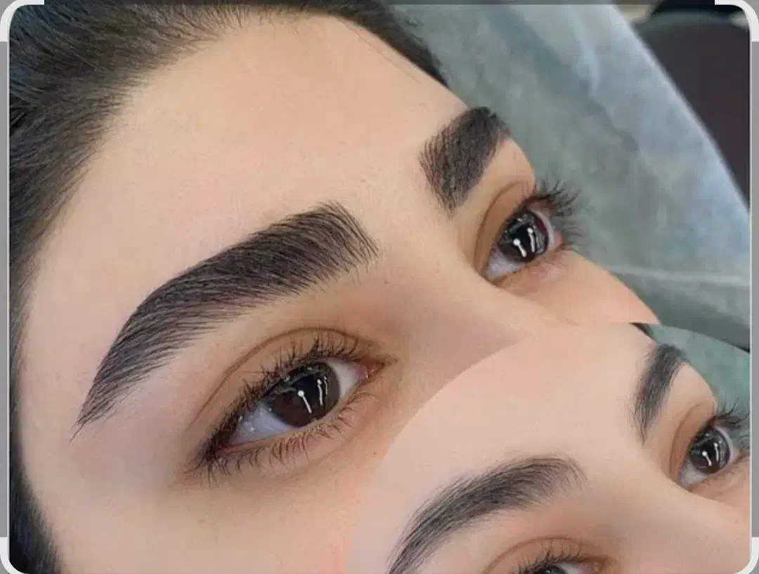 کاشت موی طبیعی و تضمینی، تزریق ژل و بوتاکس  ،|خدمات آرایشگری و زیبایی|تبریز, |دیوار