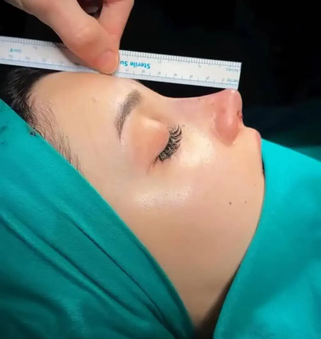 جراحی بینی اقساطی بدون پیش پرداخت|خدمات آرایشگری و زیبایی|شیراز, ملاصدرا|دیوار