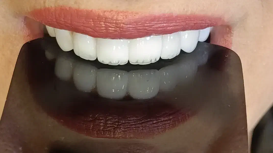 دندانپزشکی بیمه تامین اجتماعی کمیته امدادوبهزیستی|خدمات آرایشگری و زیبایی|نورآباد, |دیوار