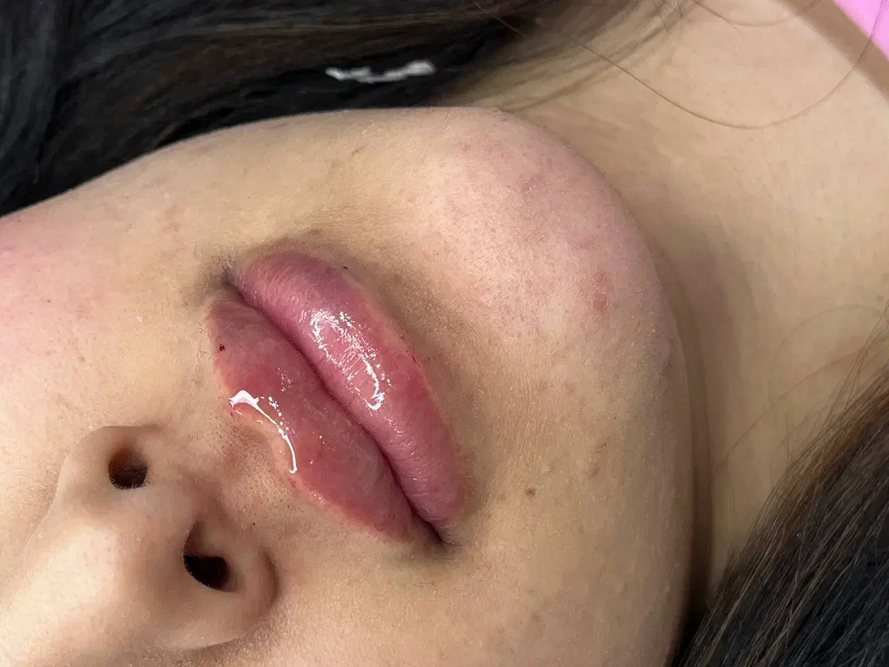 آموزش ژل و بوتاکس|خدمات آموزشی|بندر ماهشهر, |دیوار