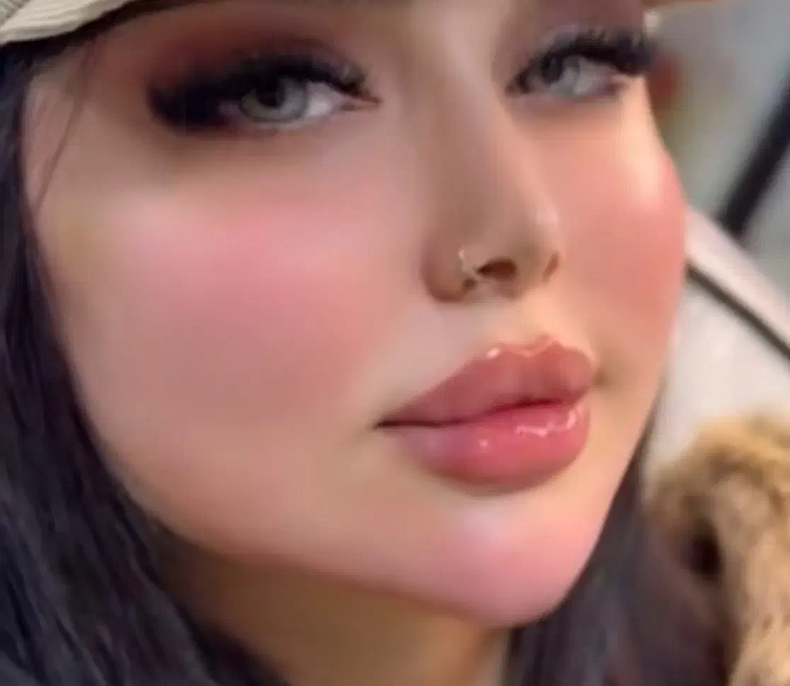 تزریقات ژل و بوتاکس|خدمات آرایشگری و زیبایی|گرگان, |دیوار