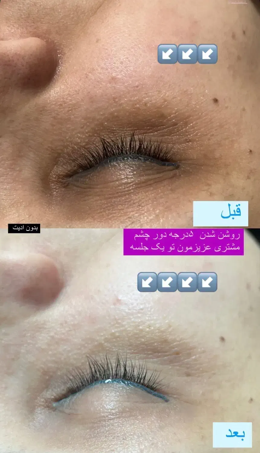 پاکسازی صورت ۲۵۰ تومن|خدمات آرایشگری و زیبایی|لاهیجان, کوی استادان|دیوار