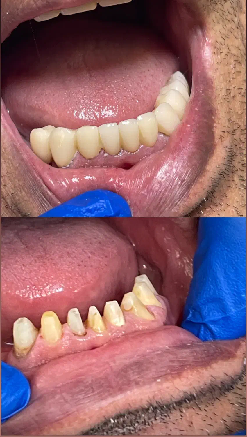 دندانپزشکی در آخونی|خدمات آرایشگری و زیبایی|تبریز, |دیوار