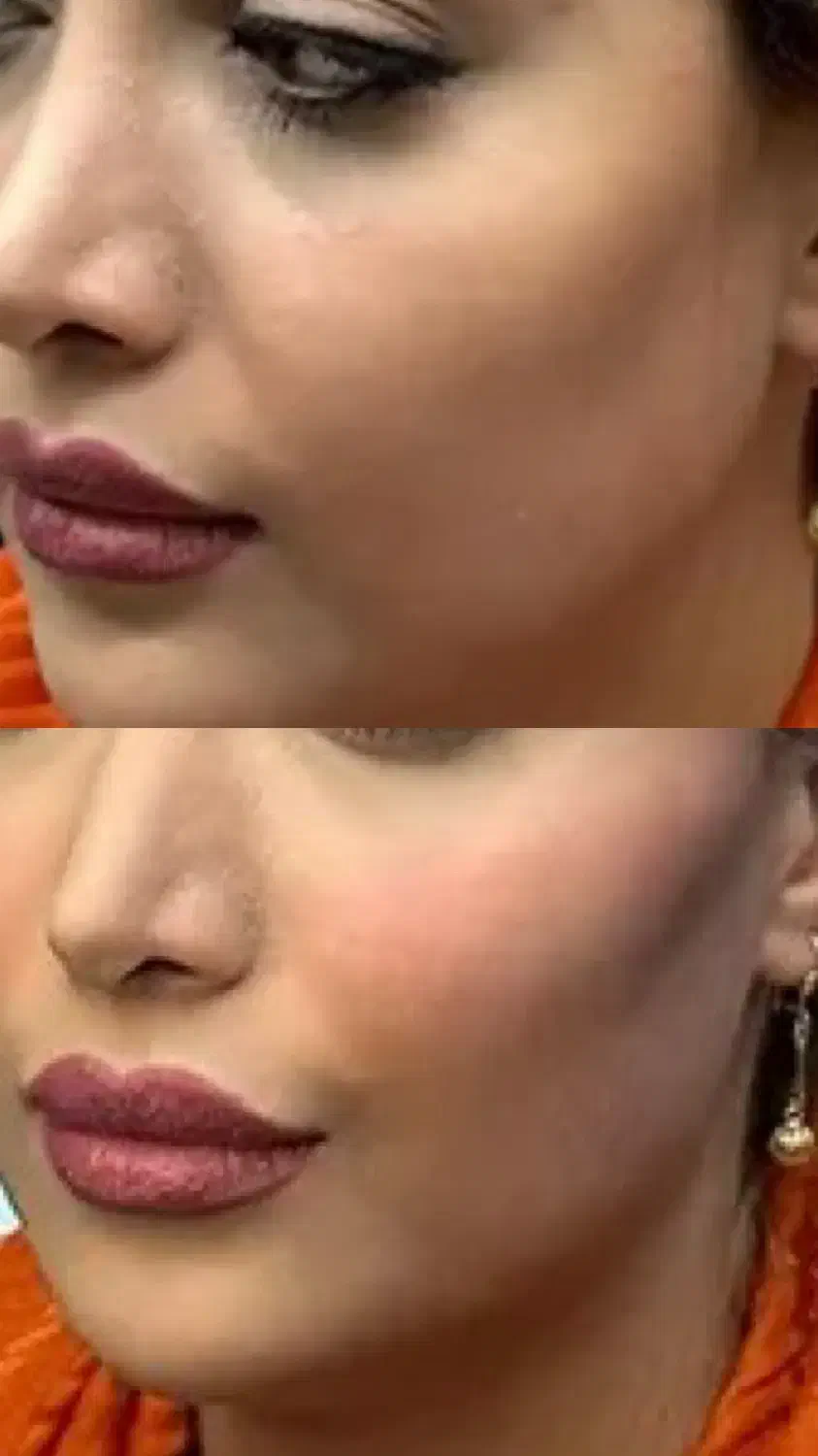 تخفیف۵۰٪ بوتاکس و فیلر (فقط یک هفته)|خدمات آرایشگری و زیبایی|ری, شهرری|دیوار