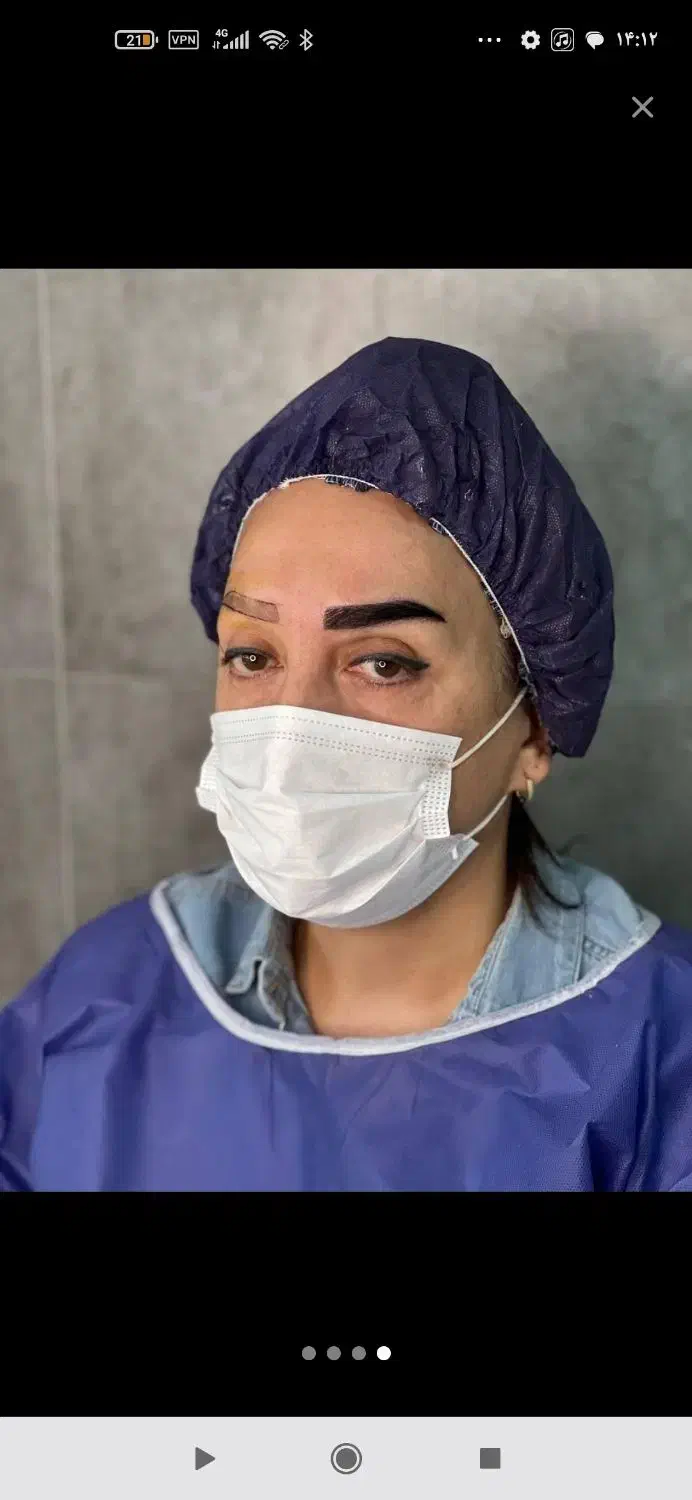 جشنواره یلدایی کاشت مو و ابروی طبیعی|خدمات آرایشگری و زیبایی|ارومیه, |دیوار