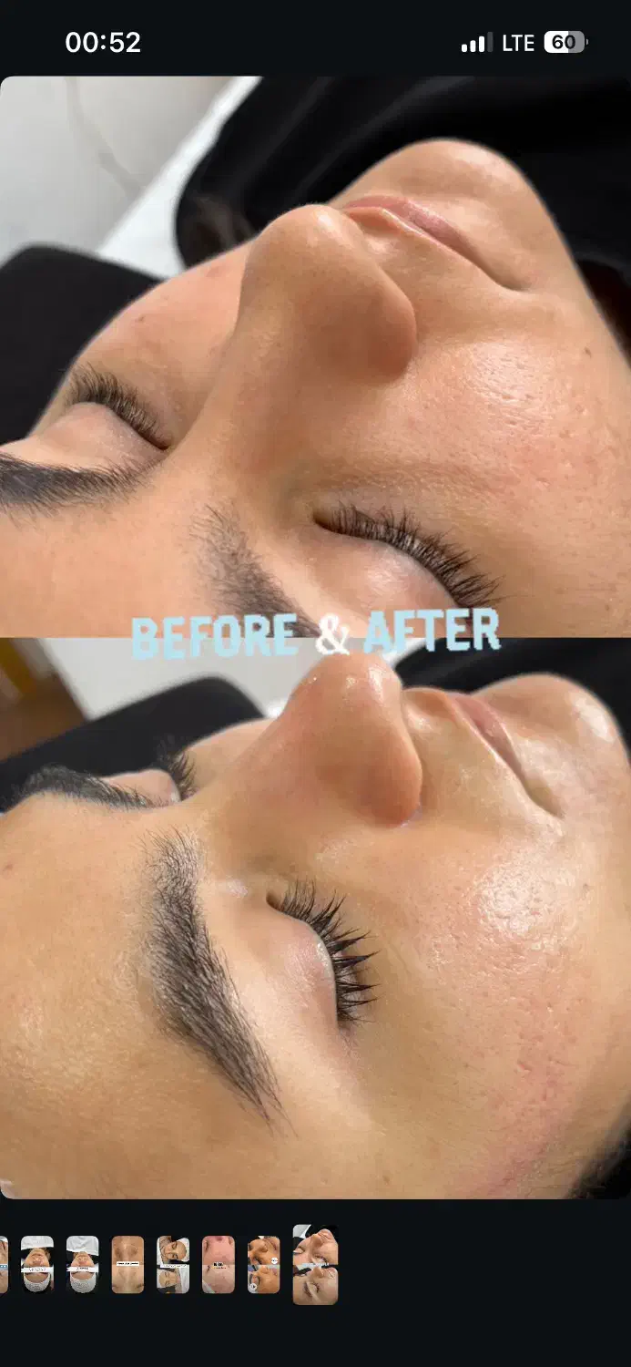 فیشال تخصصی پوست|خدمات آرایشگری و زیبایی|پرند, فاز ۵|دیوار