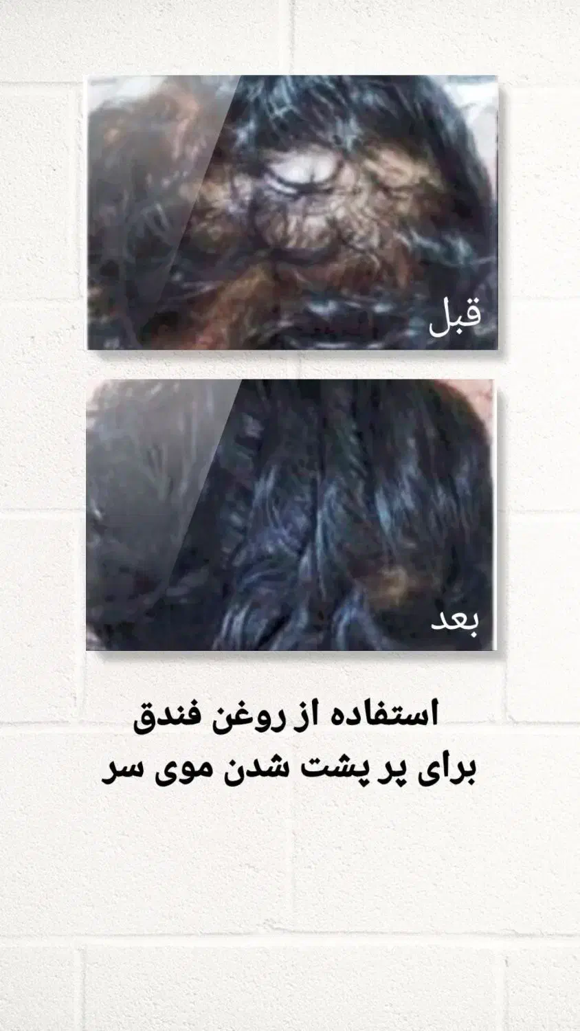 درمان اصلی ریزش مو|آرایشی، بهداشتی، درمانی|شوشتر, |دیوار