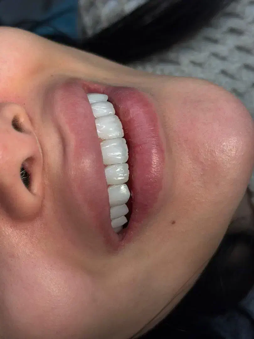 زیبایی دندان با قیمت مناسب و کیفیت بالا|خدمات آرایشگری و زیبایی|تهران, سازمان برنامه شمالی|دیوار