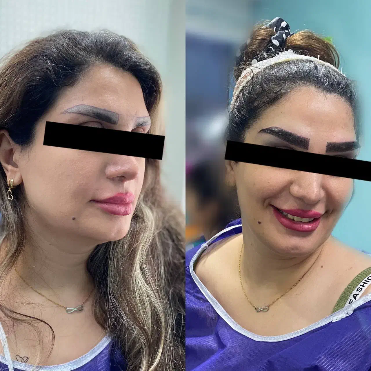 فرصت ویژه و محدود کاشت ابرو|خدمات آرایشگری و زیبایی|رشت, گلسار|دیوار