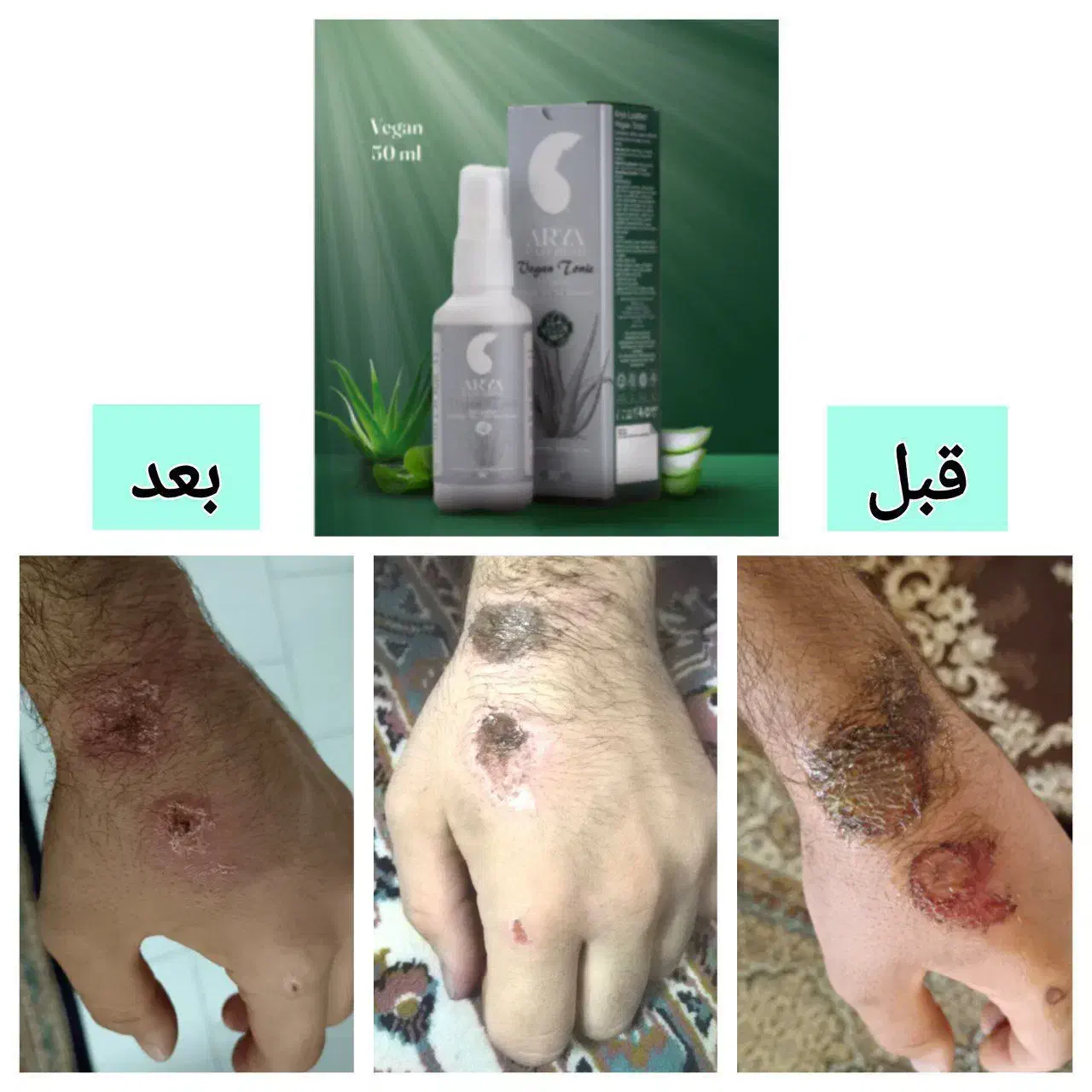 اگه ازترک پوستی رنج میبری پیام بده|فعالیت داوطلبانه|یزد, |دیوار