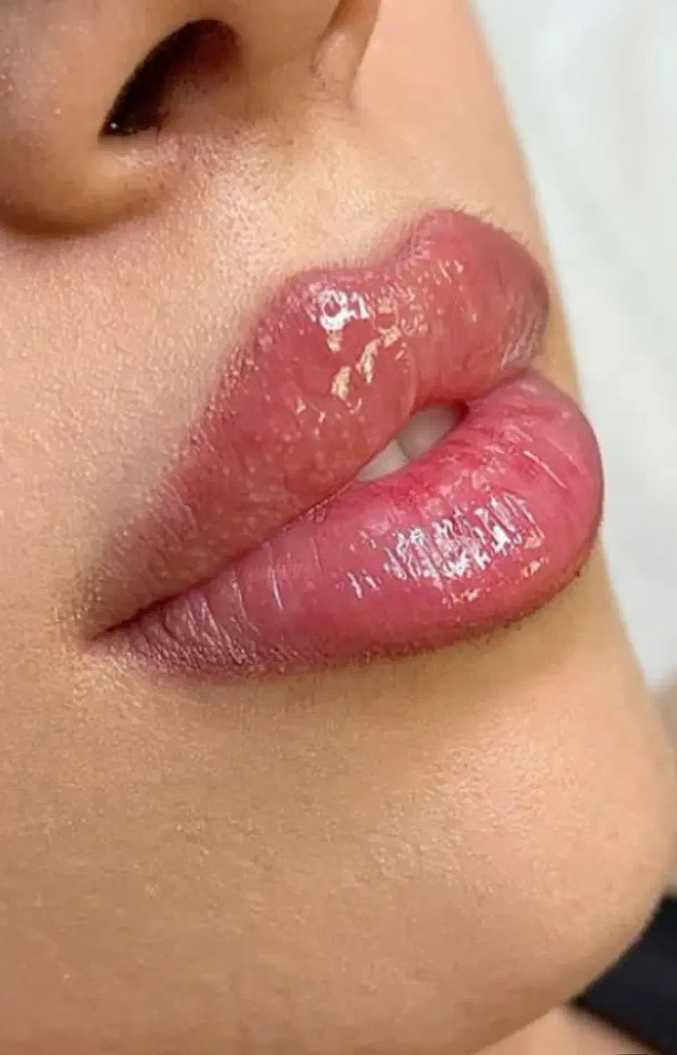 تخفیف ویژه بوتاکس فیلر و جوانسازی|خدمات آرایشگری و زیبایی|ورامین, خیر آباد|دیوار