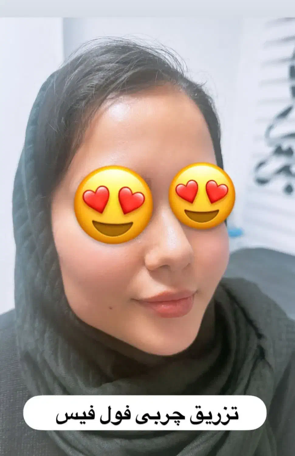 لیپوساکشن|خدمات آرایشگری و زیبایی|بروجرد, |دیوار