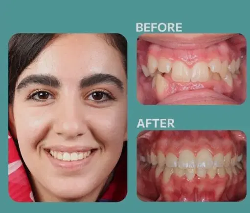 ارتودنسی رویایی، بدون یک ریال پیشپرداخت|خدمات زیبایی و سلامت|اصفهان, عطار نیشابوری|دیوار