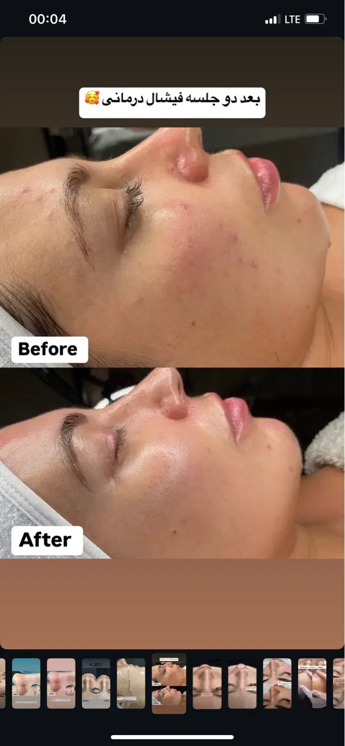 فیشیال|خدمات آرایشگری و زیبایی|قم, صفائیه|دیوار