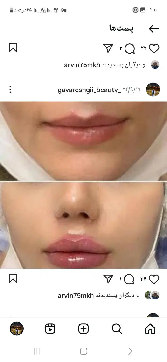 به مدل نیازمندیم باهزینه مواد|خدمات آرایشگری و زیبایی|مشهد, الهیه|دیوار